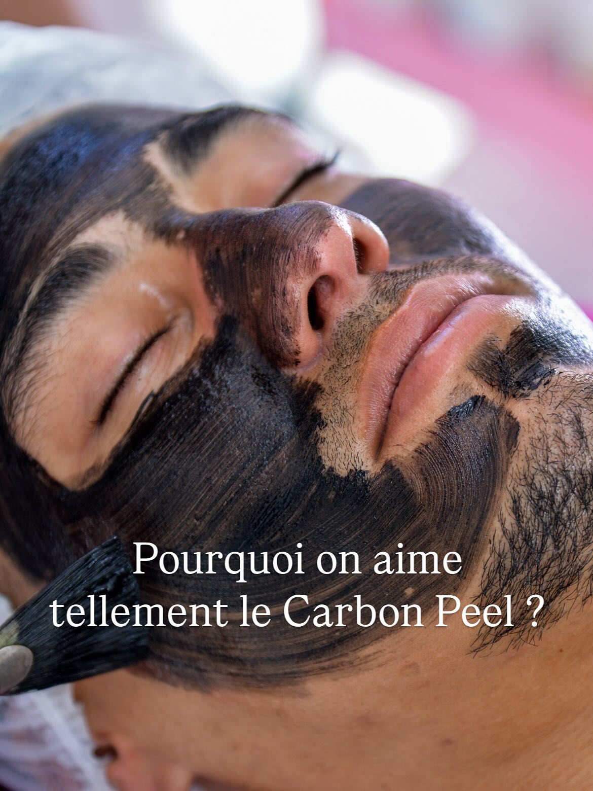 Carbon Peel RenewPlus Clinic